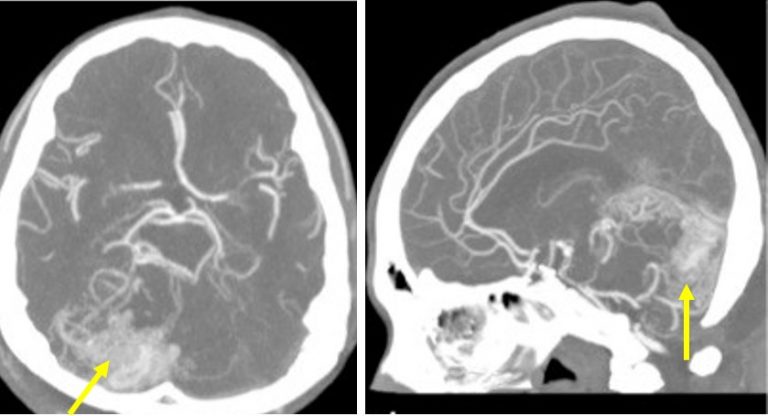 Radiology Cases Page Compilation Of Cases Emphasize On Imaging