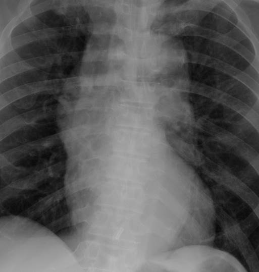 Unfolded Aorta Radiology Cases