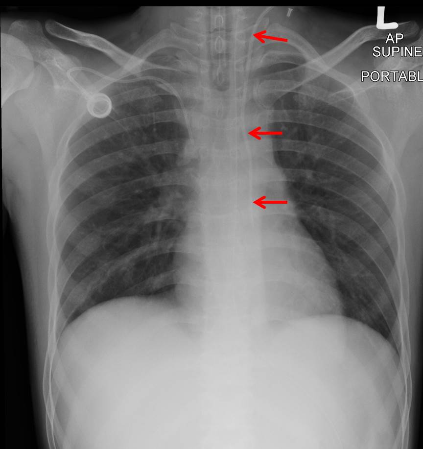 Iron Man Enter The Mandarin (2007) #1-6 (VF/NM) Complete Set main image 1