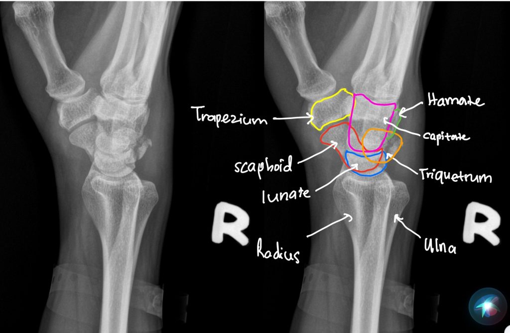 wrist anatomy xray