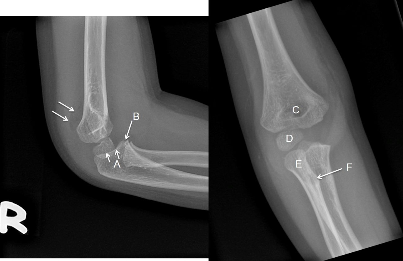 Quiz 12 – Radiology Cases