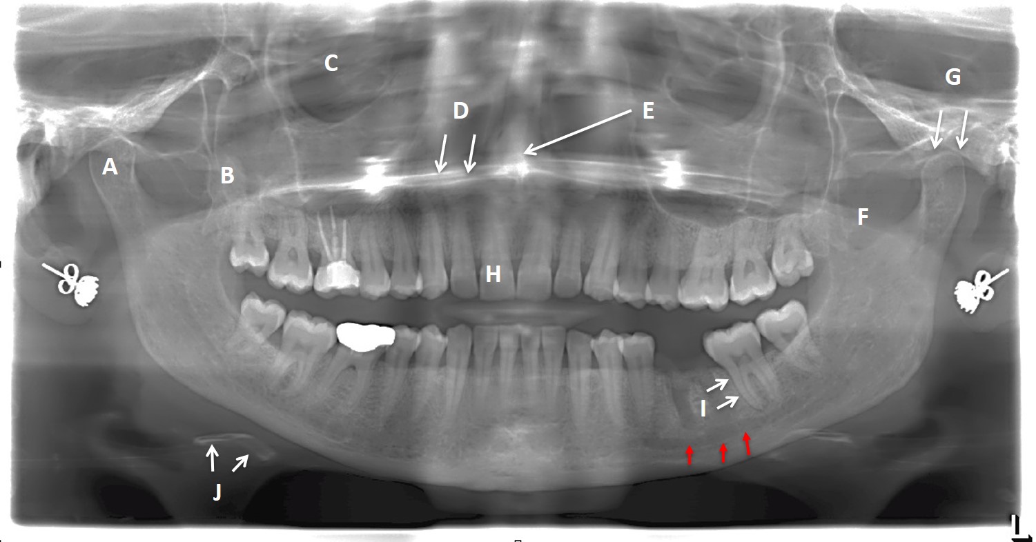 Quiz 25 Head and Neck – Radiology Cases