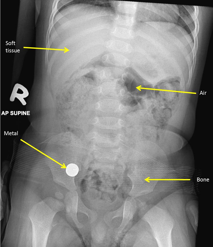 Year 4 MBBS: Principles Of X-Ray Diagnosis – Radiology Cases